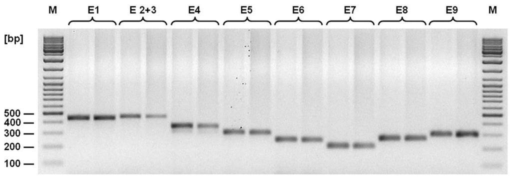 Table 8 Conditions for PCR amplification for CHEK2 fragments covering all individual exons.