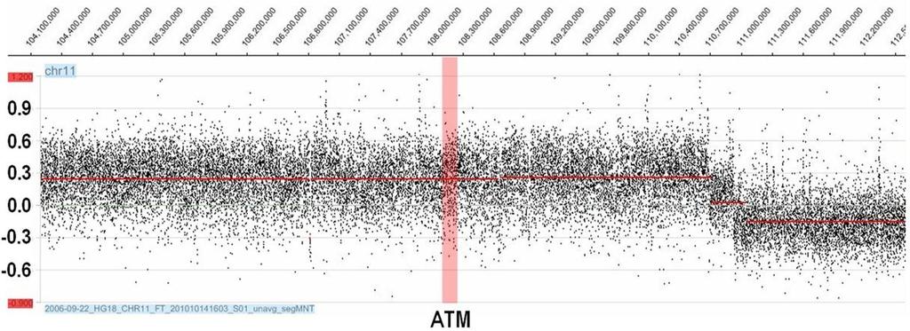 CHEK2 gene, no copy number variant was identified by acgh of chromosome 22 within the region of CHEK2 gene in general or exon 14 in