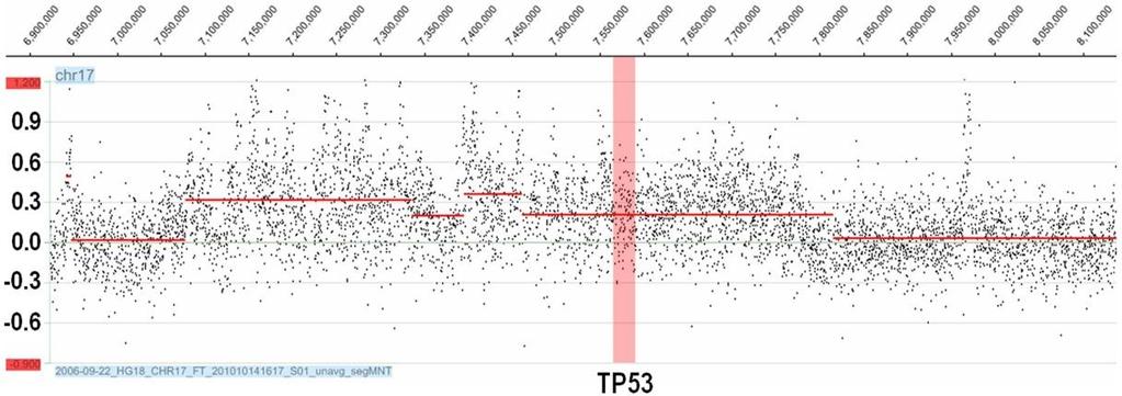 On the other hand, acgh of chromosome 11 and 17 confirmed amplification of large chromosome regions containing also ATM and TP53 genes,