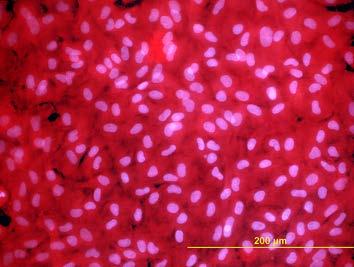 glycinem (Gly), polyetylén glykolem (PEG), bovinním sérovým albuminem (BSA),