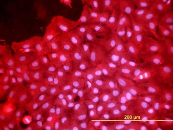 Buňky fixovány etanolem a obarveny kombinací Hoechst 33342 (modrá fluorescence) a