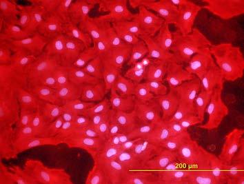 20, digitální kamera DP 70. Měřítko = 100 µm (Pařízek et al. 2009).