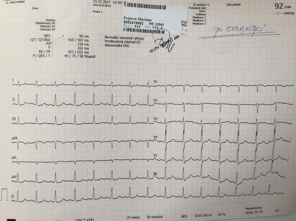 EKG cca 48