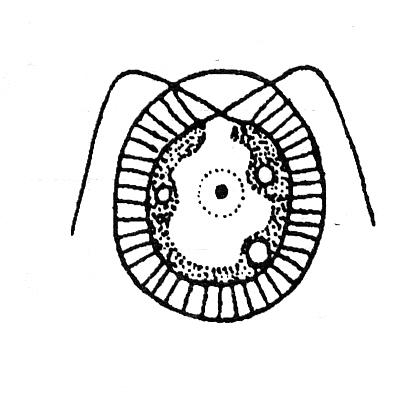 Haematococcus sp. Druh je nápadný zejména intenzivním červeným zbarvením, které je způsobeno vysokým obsahem karotenoidů vbuňce. (asthaxantin).
