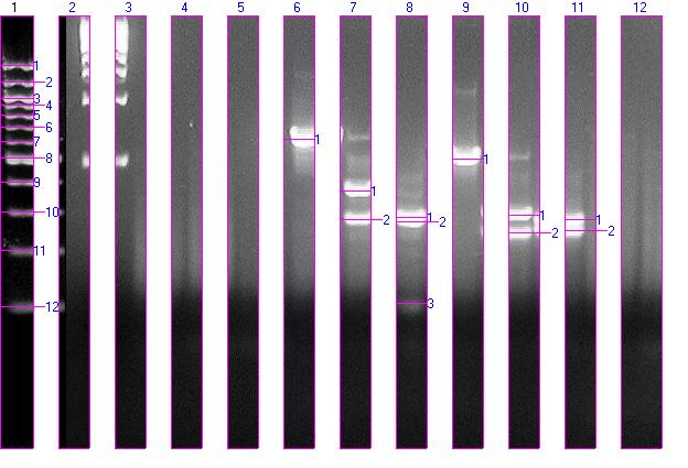 ITS/RFLP pattern obtained by using EcoRI and Hinf