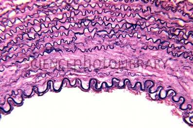 royalsocietypublishing.org/content/3/6/5 http://www.sciencephoto.com/image /579/530wm/C0057-Human_ artery_wall_cross-section._lm-spl.jpg Holzapfel, G. A. (006).
