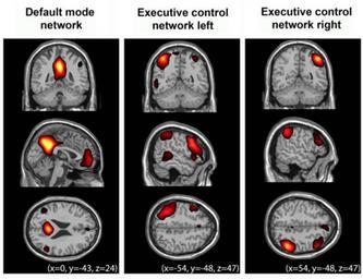 Neuronové sítě kognitivní úkoly nejsou prováděny jednotlivými centry, ale sítěmi, které spojují různé