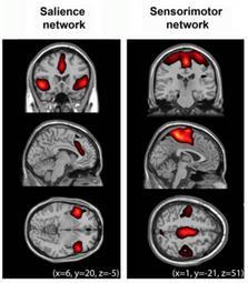 pozornost ventral attention: nečekané podněty salience network: významnost podnětů fronto-parietální: