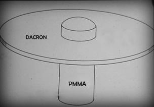 Pintucciho keratoprotéza. V roce 1979 byla vyvinuta nová keratoprotéza, jejíž autorem byl Stefano Pintucci. Model a technika implantace umělé rohovky se od té doby neustále zlepšovaly.