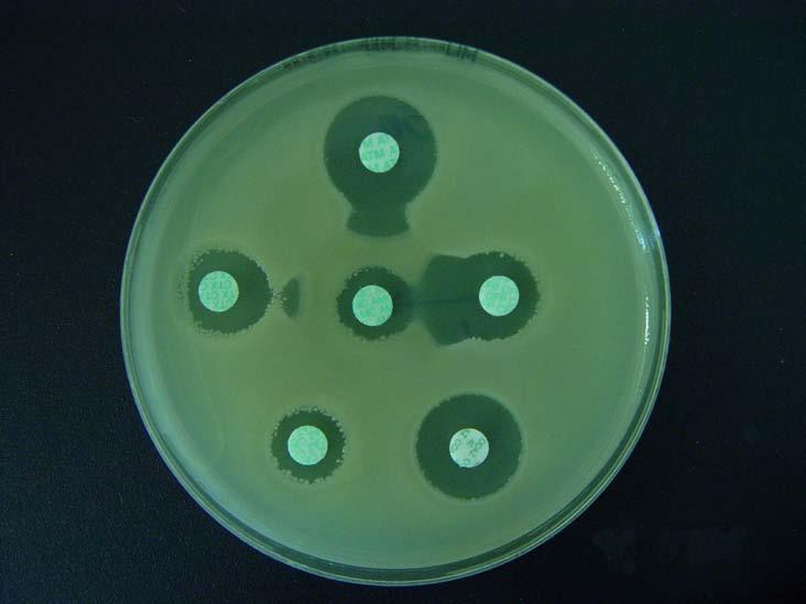 Schéma 1: Modifikovaný DDST k detekci ESBL aztreonam 25-30 mm cefotaxim amoxicilin +kys. klavulanová 25-30 mm 20 mm cefepim 25-30 mm ceftazidim +kys.