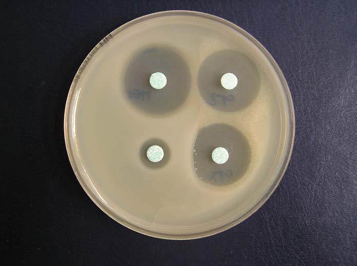 Schéma 2: Diskový test na průkaz inducibilní produkce AmpC imipenem ceftazidim 25 mm imipenem piperacilin+tazobactam 25 mm Obrázek 3: Pozitivní výsledek testu na