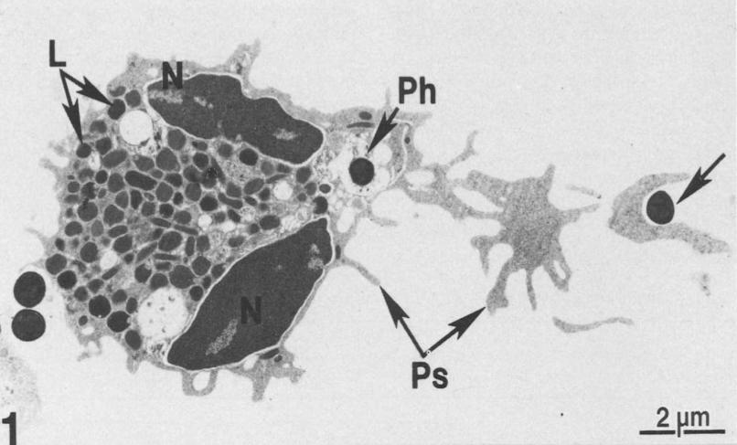 organely, fagolysozomu, (Vieira et al., 2002) splynutím fagozomu a lysozomů, které jsou v barvených buňkách patrné jako granula (Jílek, 2014).