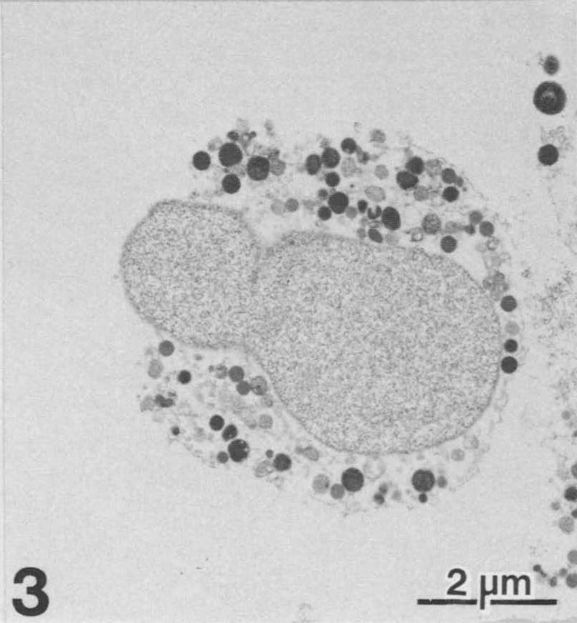 k cytolýze, tedy ruptuře cytoplazmatické membrány, a následnému vylití obsahu do extracelulárního prostoru (Haanen a Vermes, 1995; Nikoletopoulou et al., 2013).