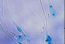 Xgal anti-sma anti-ß-iii tubulin