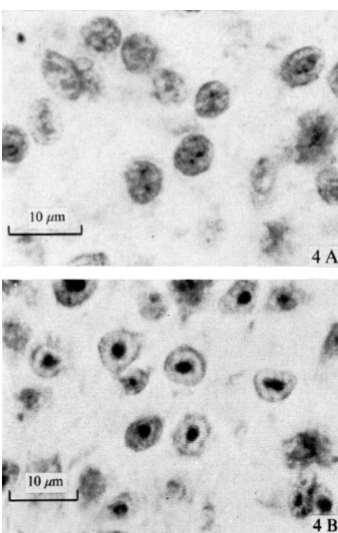 Mesenchymal derivatives of the neural