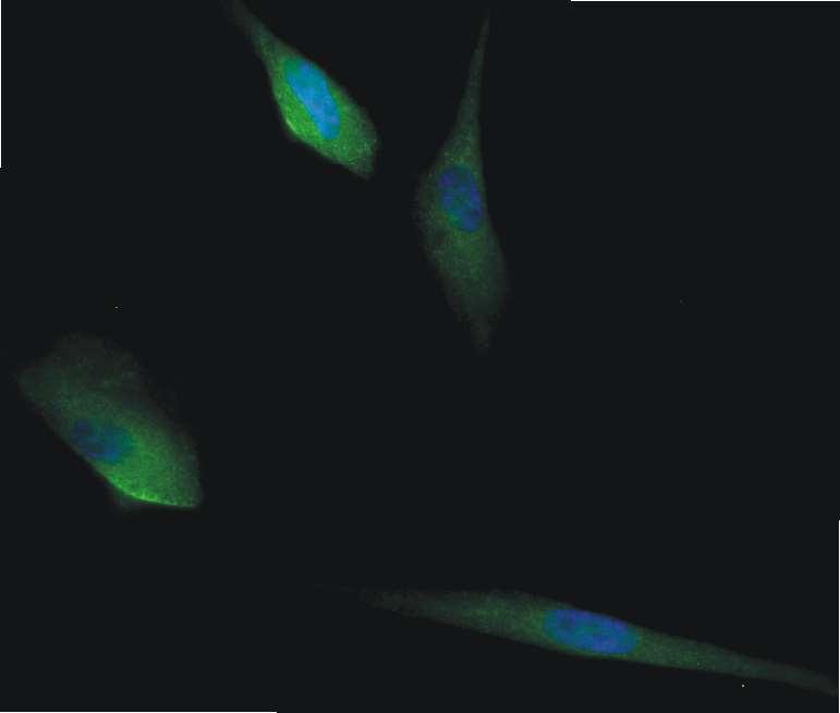 (Praha) 56, 149-157, 2010 Schwann cells Neurons GFAP Beta