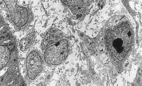 buněčná jádra bílé leghornky x buněčné jádro japonské křepelky v jádře křepelky je
