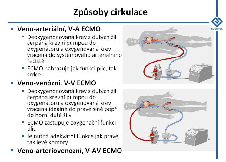 dr. František Mošna Copus S: ECMO explained.