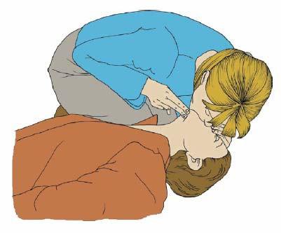 Příloha č. 8 Technika dýchání z úst do úst Po zprůchodnění dýchacích cest je umělé dýchání součástí neodkladné resuscitace.