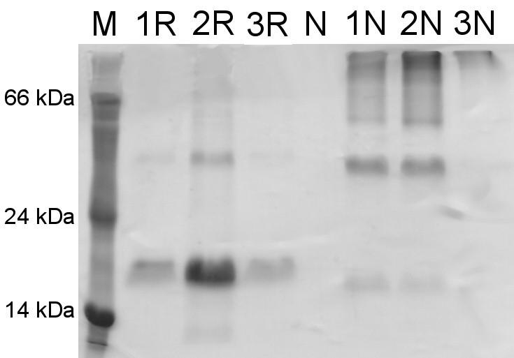 5.3.6 Ionexová chromatografie mnkr-p1c BALB na Q Sepharose FF K analýze mnkr-p1c BALB byla pouţita kolona Q Sepharosy FF (anex), jelikoţ byl protein při ph 8,5 (resp.