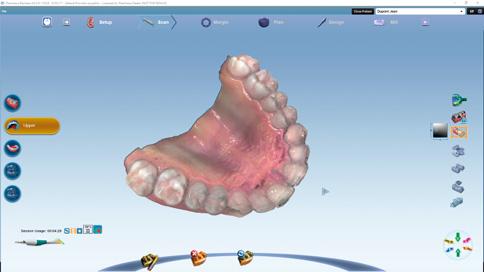 Intuitivní použití Software Planmeca PlanCAD Easy pro přístroj Planmeca Emerald je snadno použitelný, intuitivní a dostatečně flexibilní, aby přesně zapadl do vašich pracovních postupů.