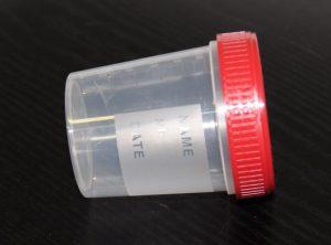 id:16 Kontejner sterilní 120 ml (TBC) moč, výpotek, punktáty většího objemu Ostatní odběrové soupravy pro bakteriologická vyšetření