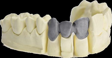 3.6 Zdravotnictví: dentální a lékařské aplikace Aditivní technologie zasahuje i do farmaceutického průmyslu. V dentálním průmyslu se věnuje tvorbě zubních korunek a celých můstků.