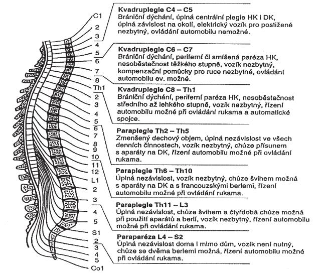 3 / Aplikované pohybové aktivity osob s tělesným postižením většinou nepoškozené. Sherill (2004) doporučuje plavání, aktivity na skútru (prkénko na kolečkách) a sporty na vozíku.