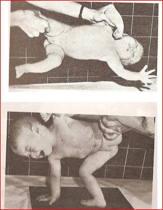 Collisové horizontála Z polohy na zádech vyšetřující dítě uchopí za stejnostranné končetiny, zvedne nad podložku do takové výše, která představuje délku horní končetiny dítěte.