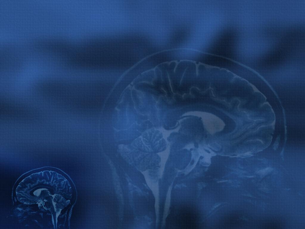Monitorování kontinuálního EEG v intenzivní péči Mgr.