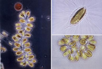 CCMs nemají Chrysophyceae, Synurophyceae