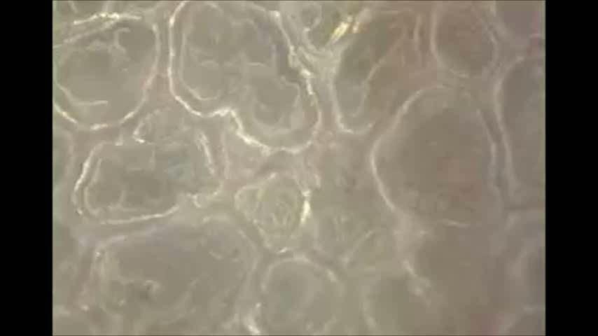 Alveolární