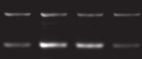 HDACs Regulate Alternative Splicing phosphorylated SR proteins including SRp40 [42] we showed that HDAC inhibition did not significantly alter the level of phosphorylated SR proteins (Fig. 2a).