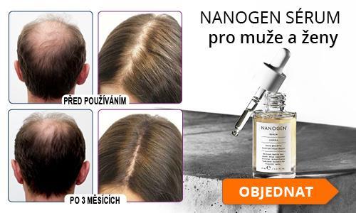 lze považovat za nejšetrnější, ale také nejúčinnější přípravek pro léčbu androgenní alopecie.