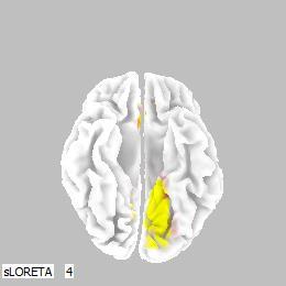 2b (dole) 3D sférický model mozku BA 7 tvoří část sekundární senzitivní korové oblasti. Podílí se na vnímání bolesti a sjednocuje jak povrchové, tak hluboké vjemy.