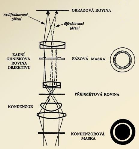 barvit a jsou přitom malé, takže se špatně rozlišují normálním světleným mikroskopem (spirochety, velké viry, mitochondrie, centrioly, lysozómy, peroxizómy).