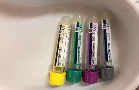 Vyšetření před podáním Ko s diff+bioch Odběr panel hepatitid, HIV Vyloučení TBC Quantiferon test VZV