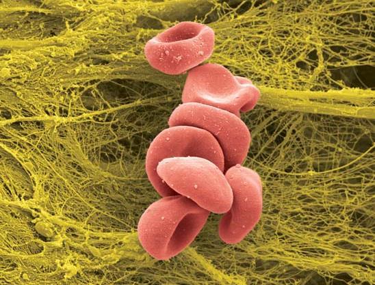 5 µm Červené krvinky Central