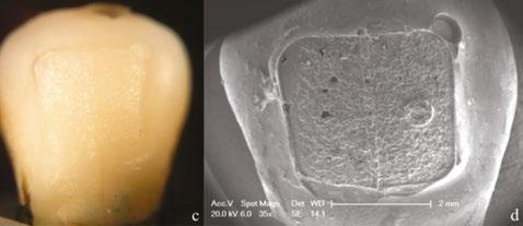 Several authors have described the deleterious effects of thermocycling in the adhesive interface after performing a SBS test (19-21).