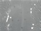 BI THERAPEUTICS A) Proliferaci tenocytů B) Neosyntézu kolagenu I prostřednictvím inhibice jeho odbourávání C) Migraci tenocytů a uzdravování rány.