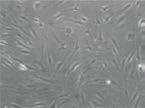 A) B) Denzitometrické jednotky x 10 3 180 160 140 120 100 80 60 40 20 0 NC 24 h 48 h 72 h Proteinové hladiny MMP-1 24 h 48 h 72 h no coating NC MD- MD- MD- Tissue NC Tissue NC Tissue Obr.
