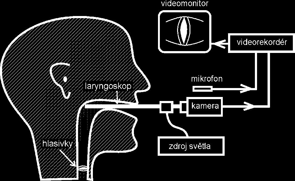 (Z publikace [8]). Kmitání hlasivek je příliš rychlé na to, aby je bylo možno přímo sledovat okem či standardní videokamerou. Již od 19.