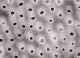 (200x) ukazují dentinové kanálky po opracování, ošetření pomocí NaOCl a další expozici