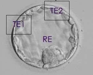 VÝSLEDKY Embryo category TE1 TE2 RE Total 89 Euploid 18 30 30 Aneuploid 66 55 53 Mosaic 5 4 6 Errors