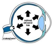 Nitrooční tlak Běžná tonometrická metoda používaná v oftalmologii. Důležitý pro včasnou diagnostiku očních chorob, např. glaukomu.