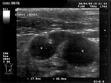 Biosignál EKG je U(t) biosignál, který poskytuje informaci o fyziologii nebo patologii srdce.