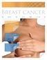 reast cancer 5 str. 10 str. N E W S Pohled chirurga na operační zákrok po neoadjuvanci Pacientka s invazivním duktálním karcinomem prsu