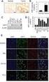 NOVEL PROSTATE CANCER TUMOUR MARKERS IN A CELL LINE MODEL