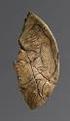 Palaeolithic and Mesolithic of Northern Moravia and Czech Silesia