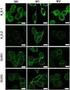 FUNCTIONAL EXPLOITATION MACROPHAGES DURING THE RESOLUTION OF BOVINE MAMMARY GLAND ACUTE INJURY